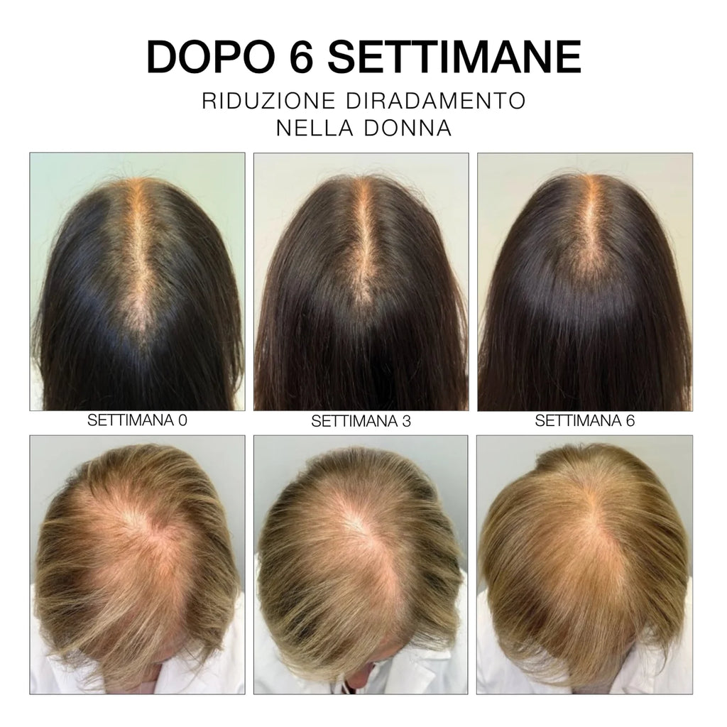 Rosemary Hair & Scalp Strengthening Oil