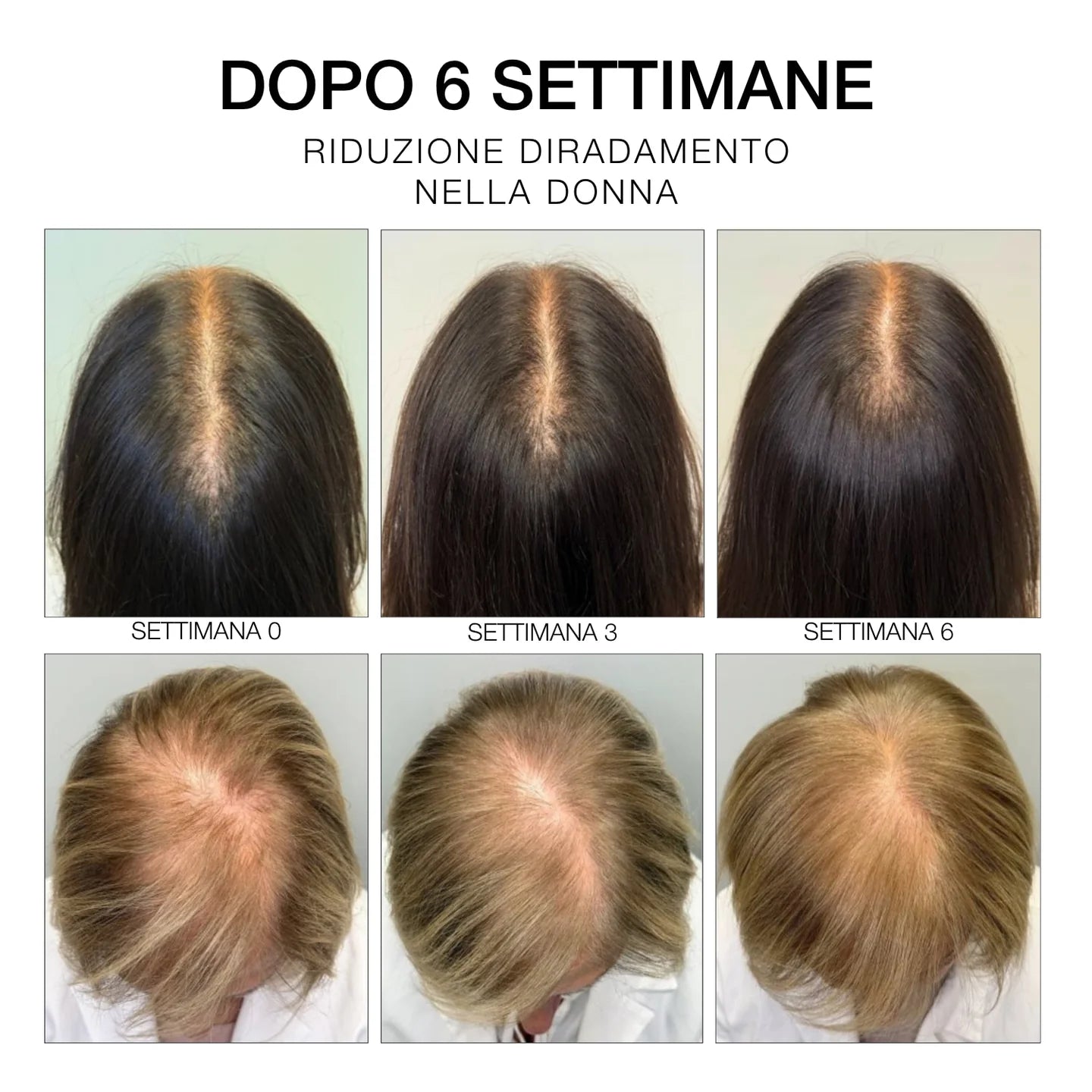 Rosemary Hair & Scalp Strengthening Oil